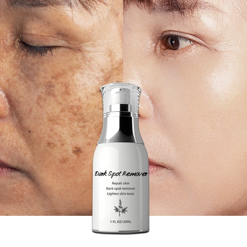 

Hot sale facial serum Repair skin face serum Dark spot remover lighten skin tone whitening serums