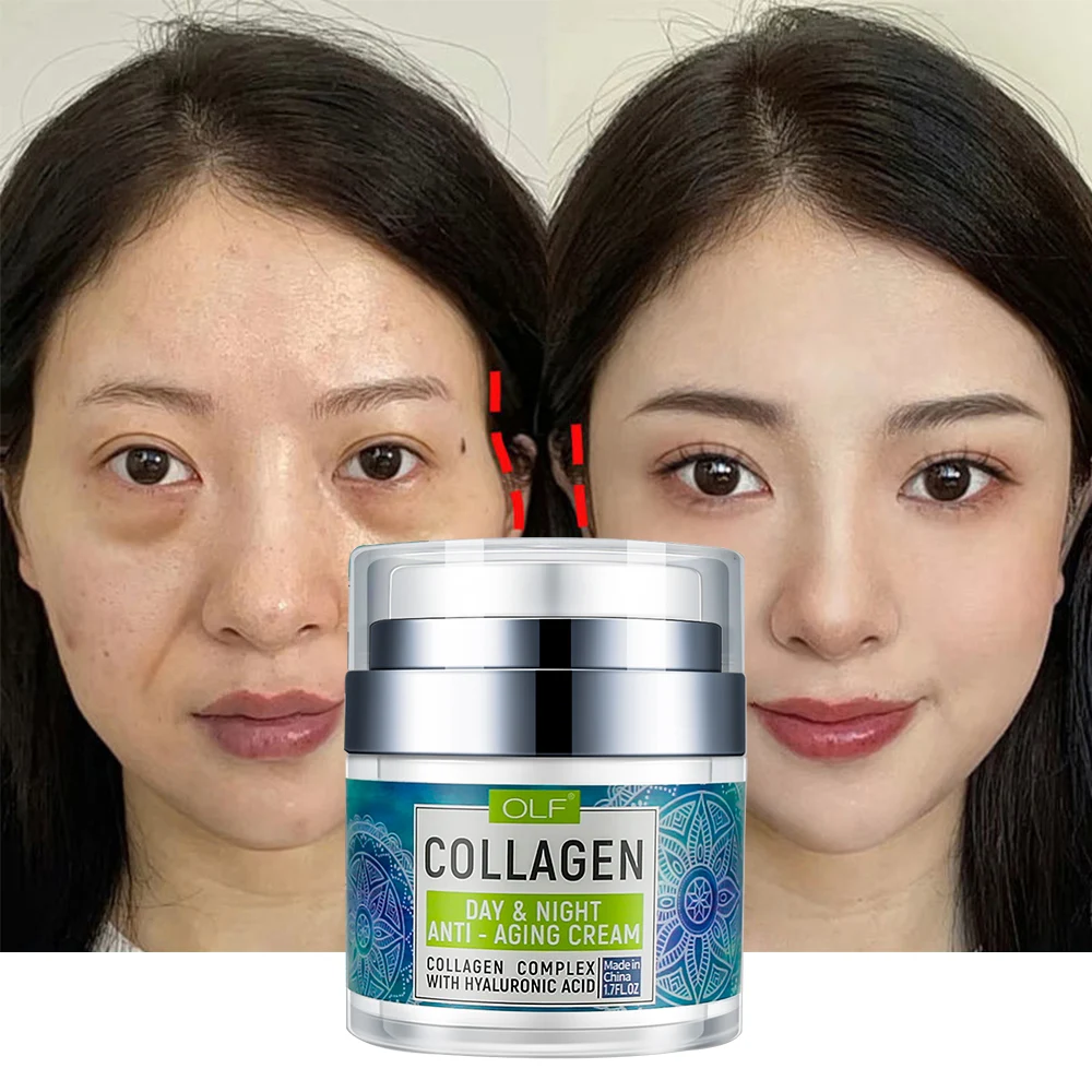 

Handmade Anti Aging Protein Removal Collagen Cream For Face Wholesale Day And Night Massage Collagen Plus Vit E Cream