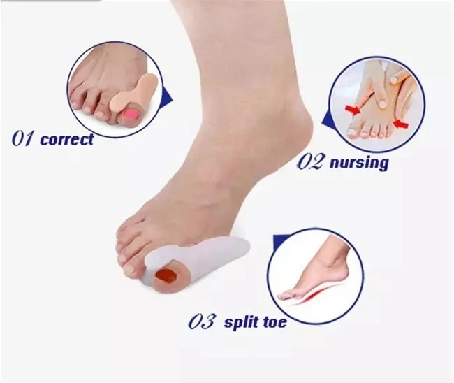 toe corrector (7).jpg