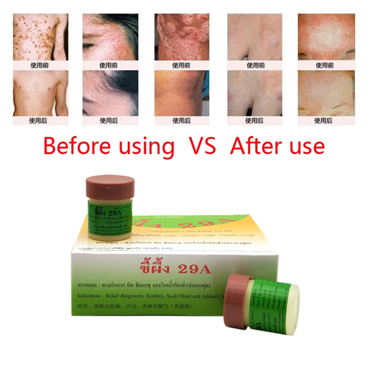 Thailand 29a Natural Ointment Psoriasi Eczma Cream Skin Ointment For Eczema Skin Protect Ointment Buy 29a Thai Psoriasis Eczema Cream 8g Skin Ointment For Eczema Skin Protect Ointment Ointment For Psoriasis Product On