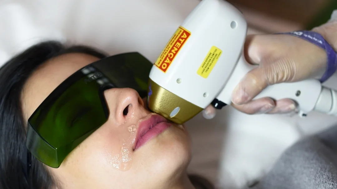 Newest Diode Laser Hair Removal Machine 808nm Diode Laser Hair Removal