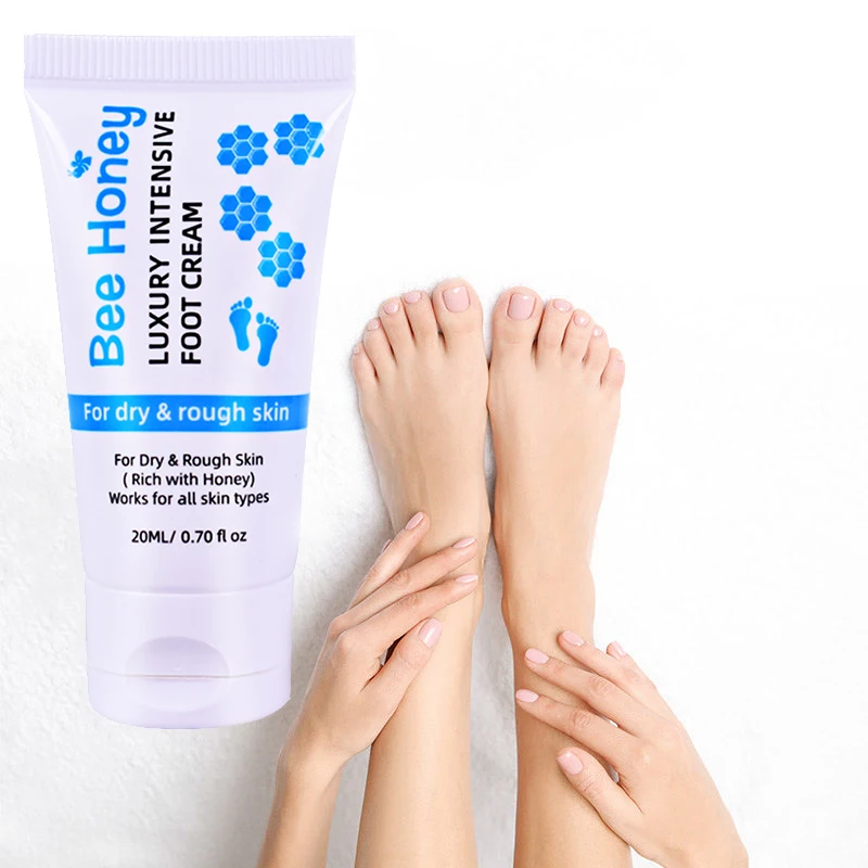 

20ml Mini Callus Remover Hand Foot Elbows Knees Intensive Moisturizes Softens Exfoliates Dead Skin Urea Foot Cream