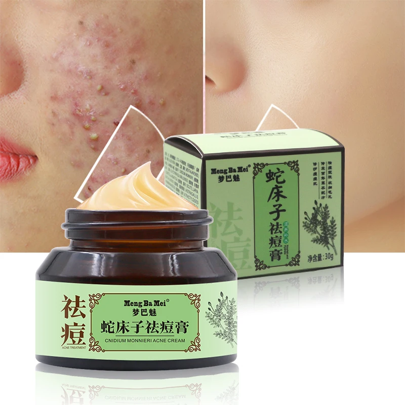 

High Quality Gentle Facial Whitening Moisturizing Organic Scar Removal Anti Acne Treatment Acne Cream