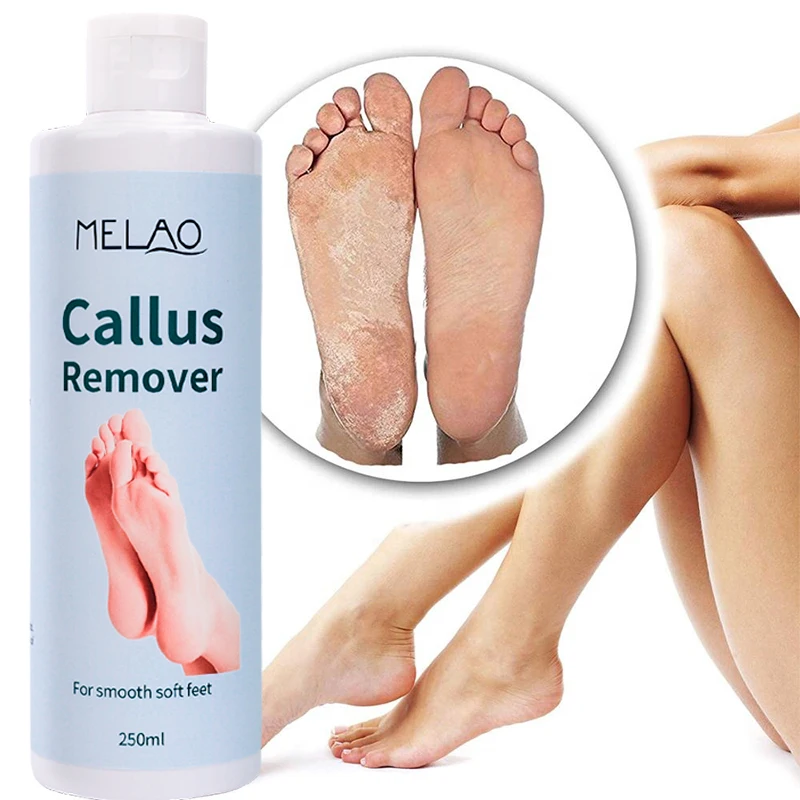 

Wholesale Private Label Foot Care Remover Dead Skin Eliminator moisturizing anti inflammatory foot Foot Exfoliator Gel