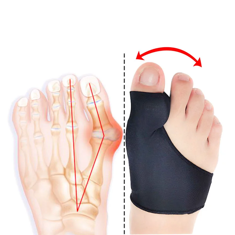 

Hallux Valgus Corrector Toe Spacer Feet Care Products Foot Protection Silicon Gel Bunion Protector, Skin