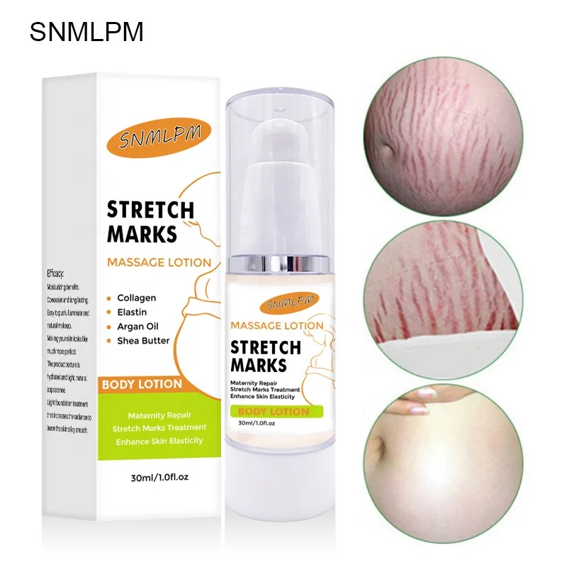 

30ml produit vergetures best pregnancy stretch marks remover removal stretch mark cream