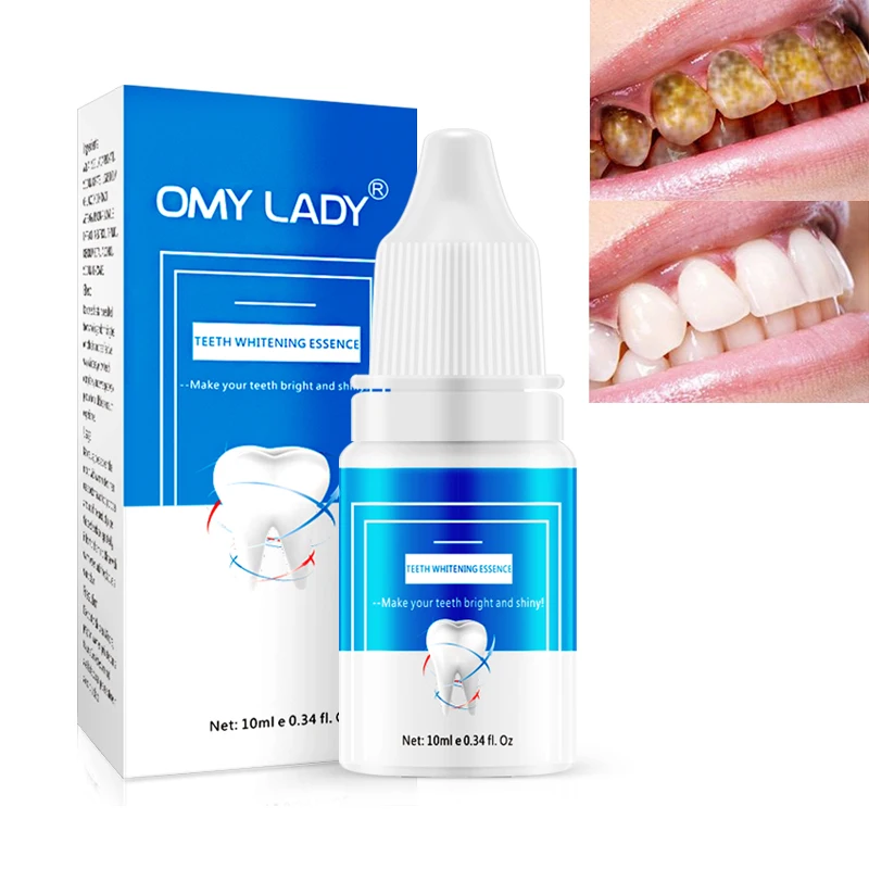 

Omylady Fast Effect Teeth Whitening Kit dentifrice For Teeth Cleaning