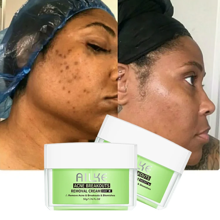 

Organic Facial Skin care injection dark spot blackhead remover Acne treatment kit set for acne