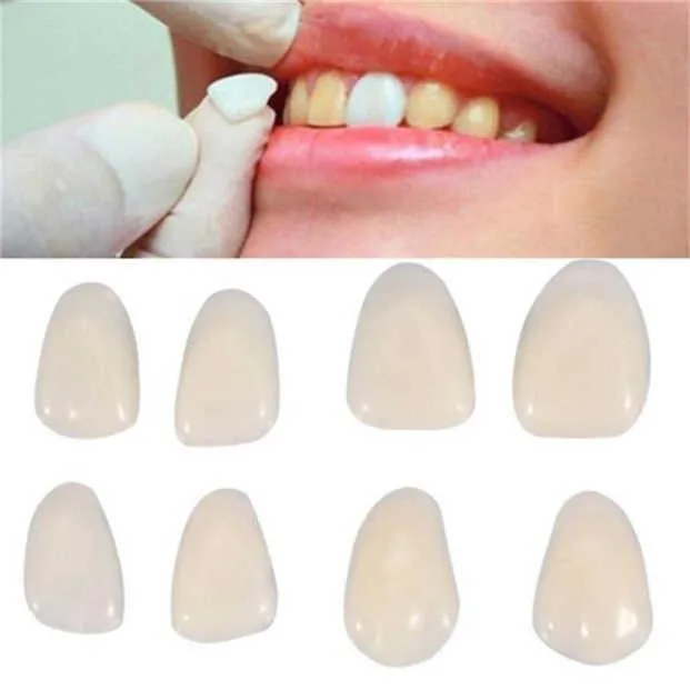 

Dental Ultra-Thin Whitening Veneers Resin Teeth Upper Anterior Teeth Beauty Health Tools Without Glue