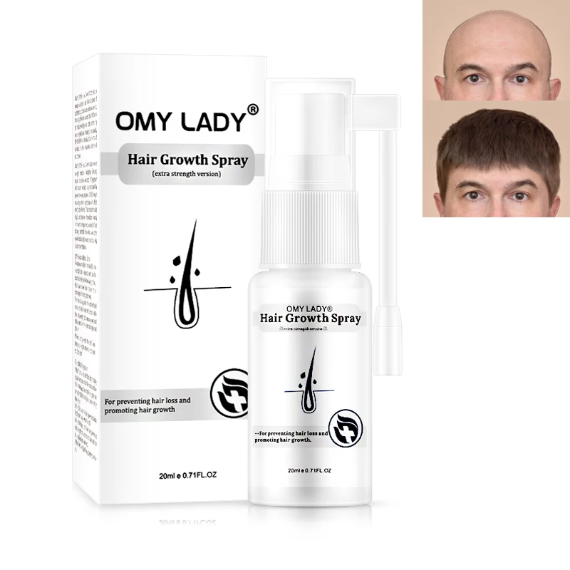 

2020 Christmas Gifts Idea Omy boy Hair Growth Serum for your Boy friend & husband