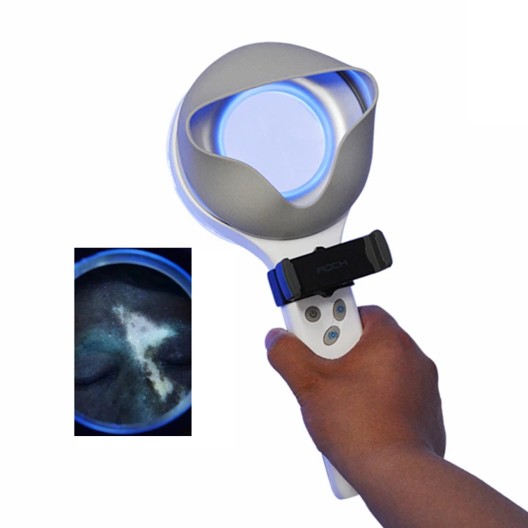 

Competitive price medical skin analyzer LED UVA light wood's lamp