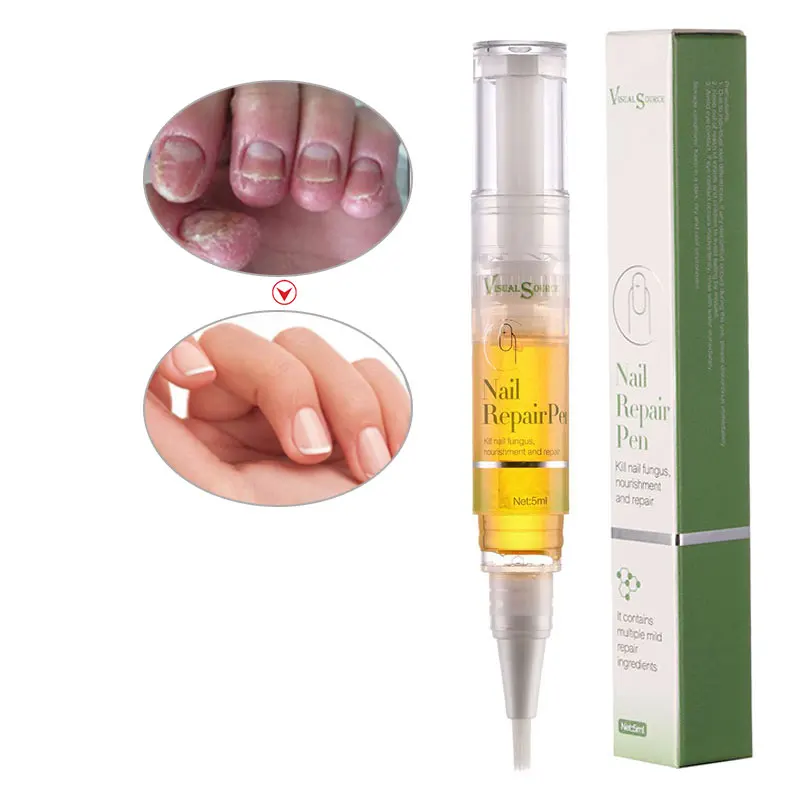 

Free Sample Nail Care Repair Essence Nail Treatment Remove Onychomycosis, Transparent