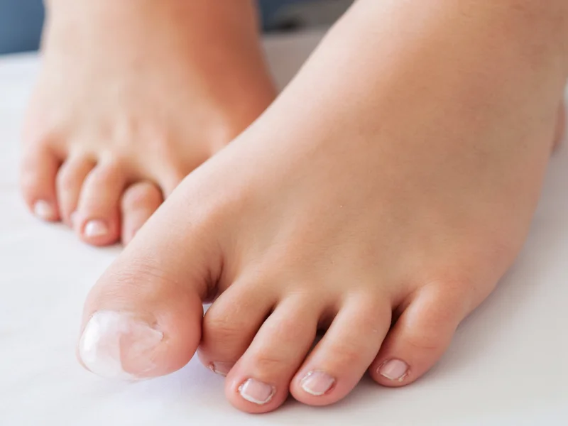 Healthy feet showing smooth skin after proper pedicure