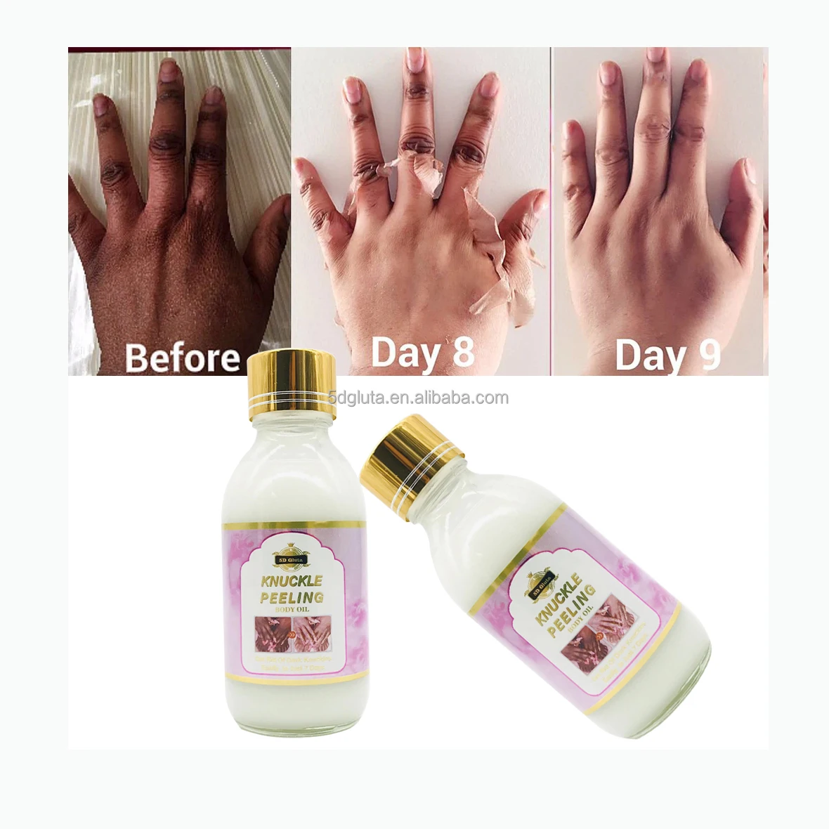 

Natural Organic Serum Whitening Bleaching Gluta Remove Dark Knuckle Elbow Knee Peeling Serum