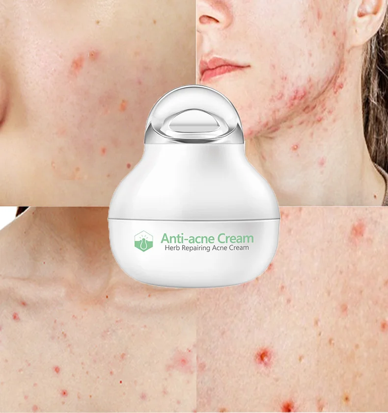 

Herbal ointment 8g skin care product moisturizing cream anti-acne and anti-wrinkle