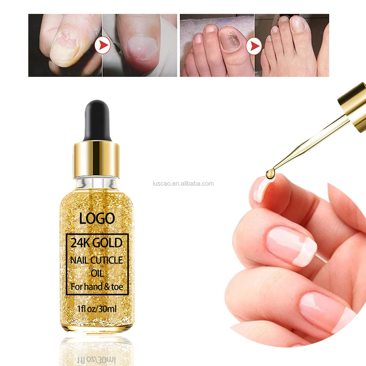 Repairing Damaged Hands And Toes Nails Brightening Oem 30ml Nail