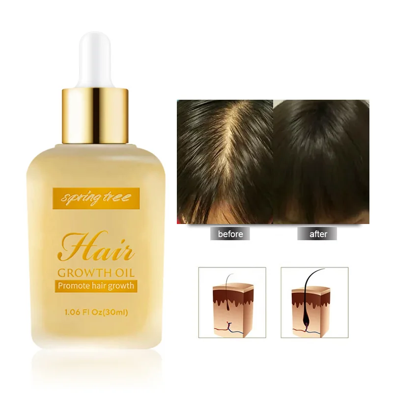 

Private label Organic Anti-Hair Loss Hair Growth Serum Hair Regrowth Treatment Oil