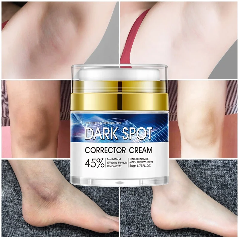 

Best Dark Spot Remover Body Sensitive Skin Whitening Cream Natural Instant Effect Intimate Area Underarm Brightening Cream