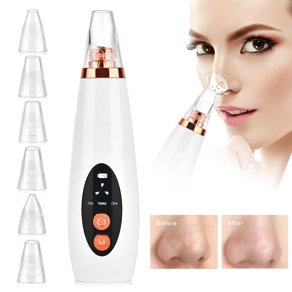 

Facial Pore Cleaner Blackhead Remover Vacuum Acne Comedone 3 Suction Intensity 6 Probes