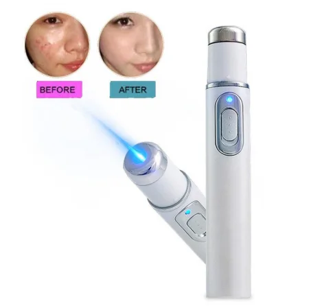 

Wrinkle Removal Pen for dropshipping