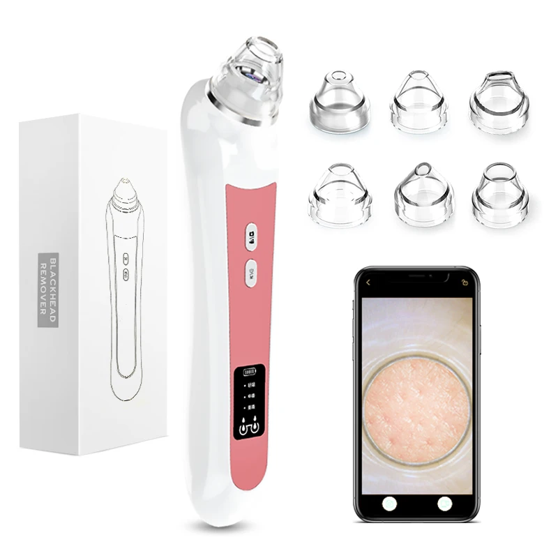 

Timesiso H200 blackhead remover electric comedone extractor kit, White/green/pink