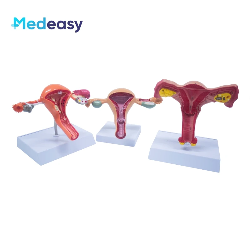 

Female Uterus and Ovary Anatomical Model Vagina Model Plastic Uterus Model Normal Uterus Model