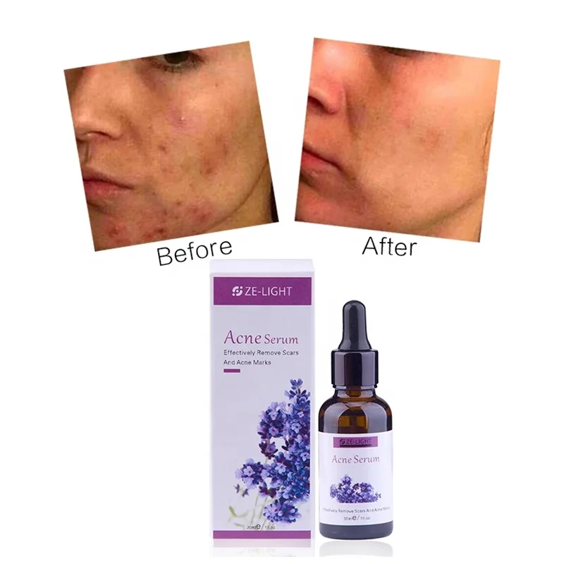 

Vitamin C Whitening Face Serum Cream Remover Acne Treatment Fade Dark Spots Anti-Aging Skin Care Lavender Serum, Transparent