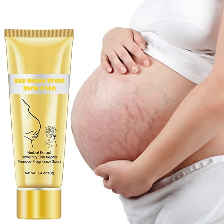 

NEW effective stretch mark removal cream mango pregnancy for marks private label anti lanbena repair stretch mark cream