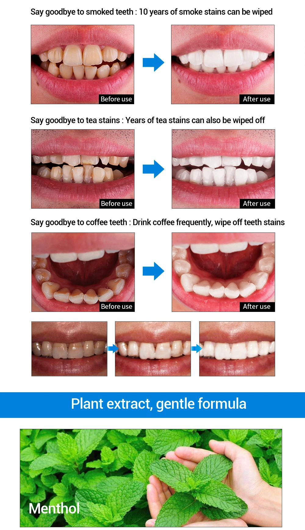 LANBENA blanchiment des dents portable essence liquide en gros