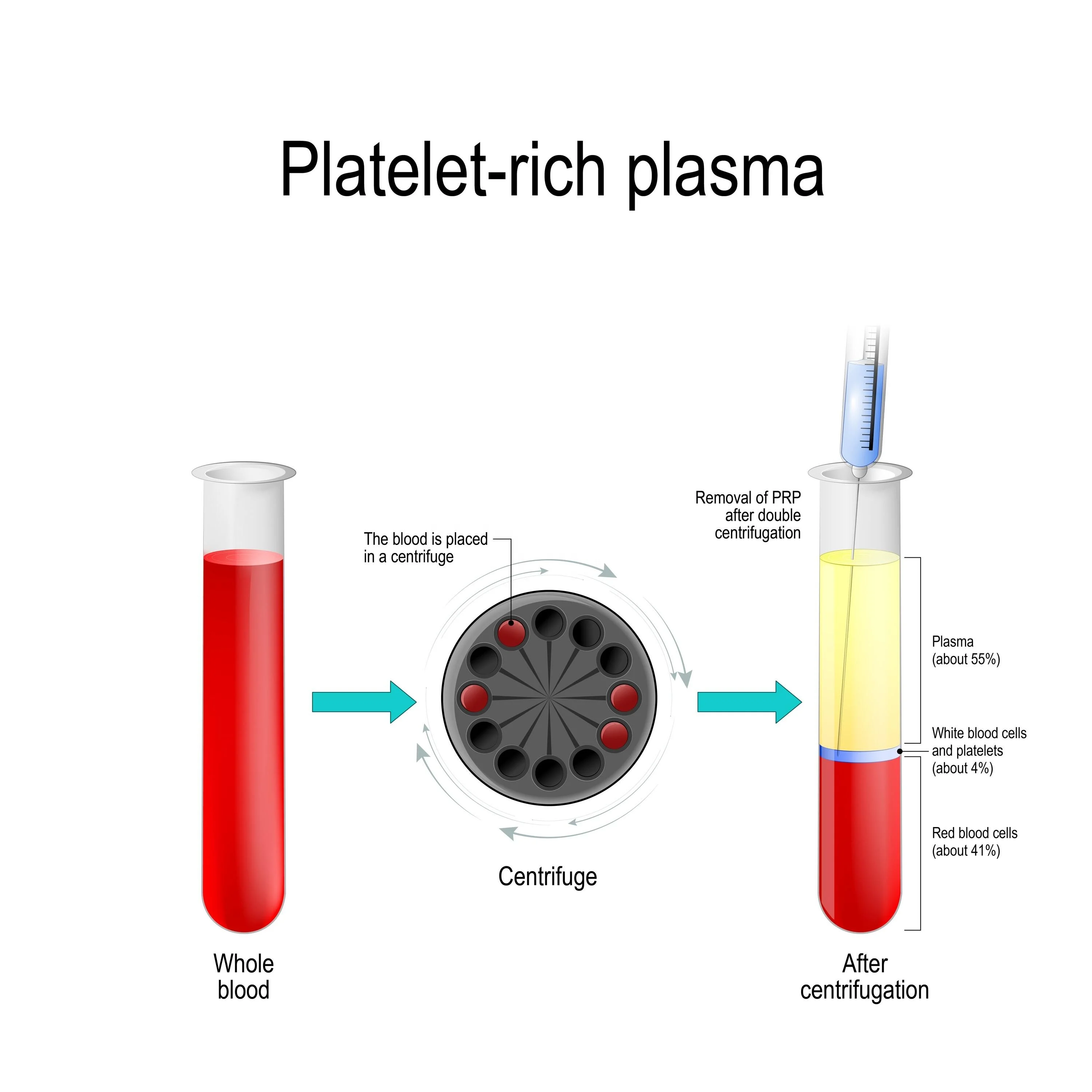 Центрифугирование плазмы крови