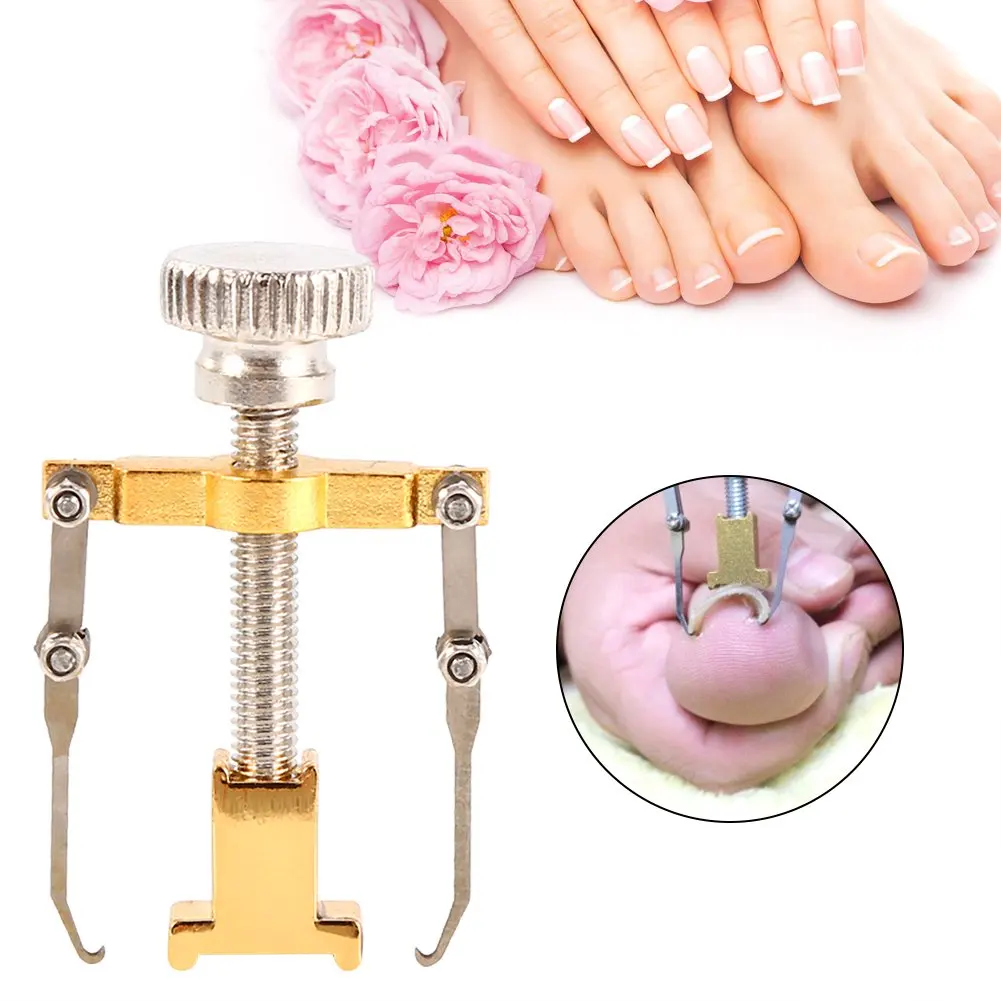 

Stainless Steel Treatment Pedicure Tool Toe Clamp Ingrown Toenail Correction Lifter, Silver, gold