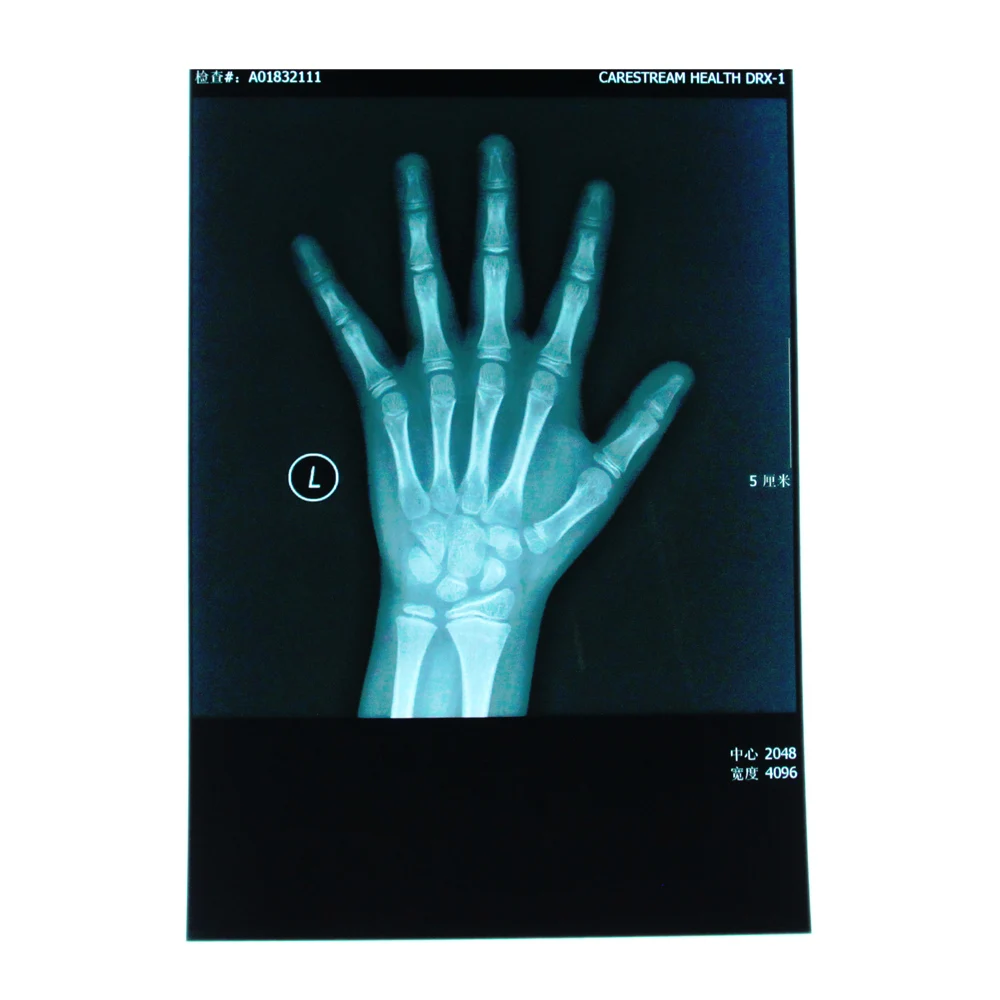 
PET based blue Fuji medical x-ray film laser X-Ray film 