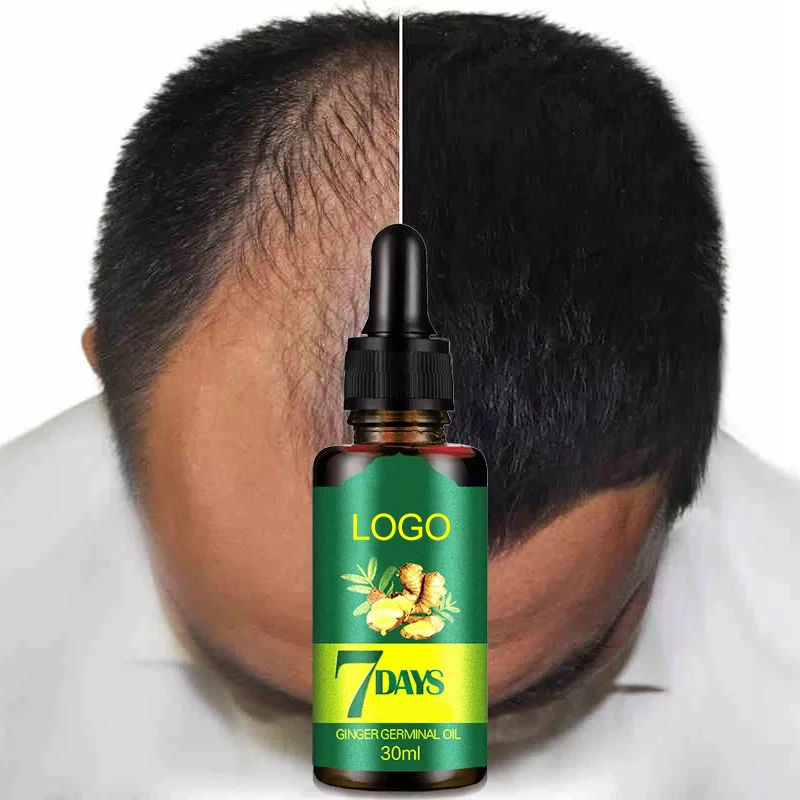 

2021 Factory price custom logo Ready-made Pure Ginger Essential Oil improving Hair Growth Anti Hair Loss Treatment for men