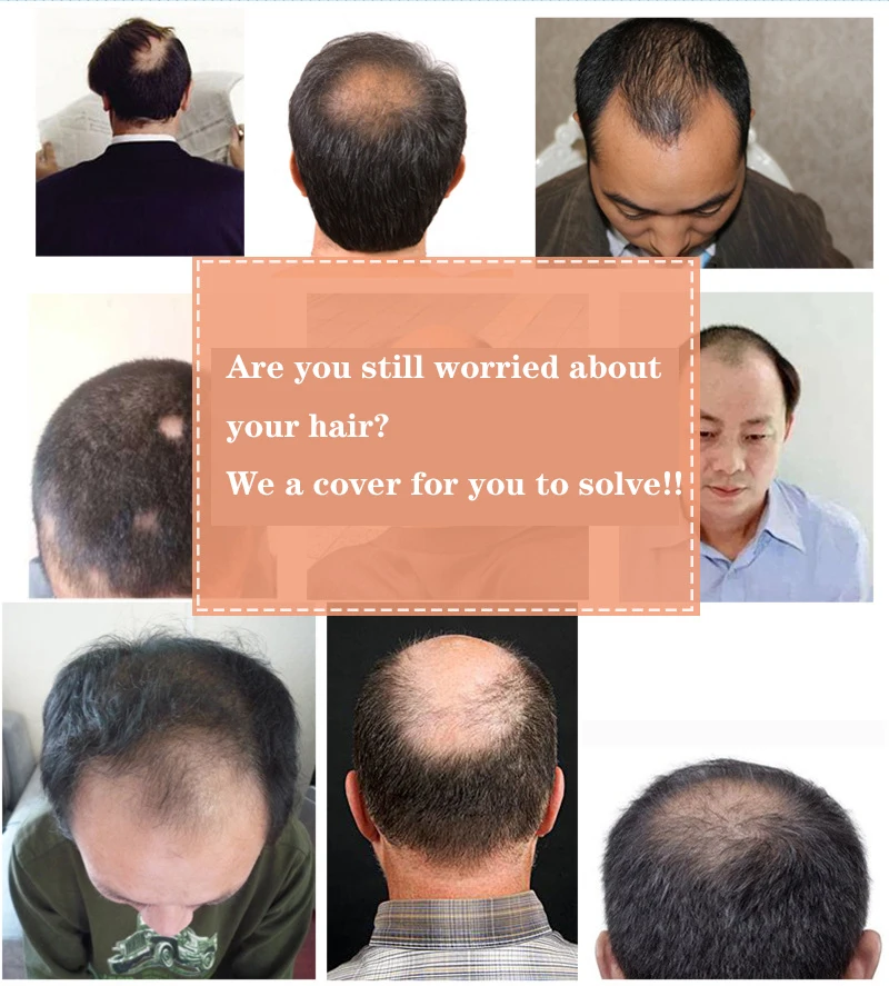 Replace hair on top man1 .jpg