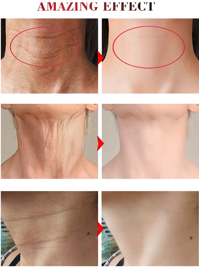 neck whitening cream for men