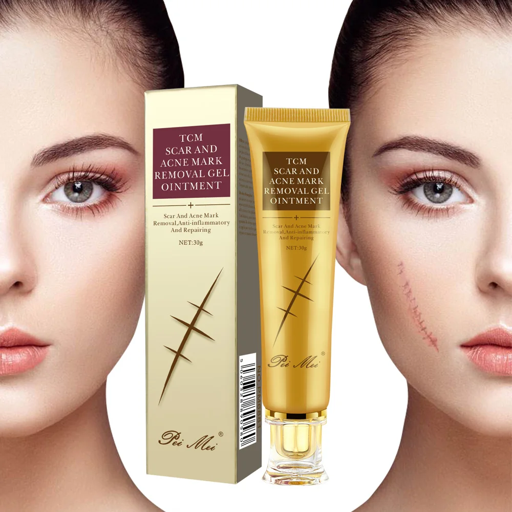 

High Quality Scar Removal Cream OEM Blance Skin Color Acne Cream Dark Spot Removal Face Care Creams That Remove Scars