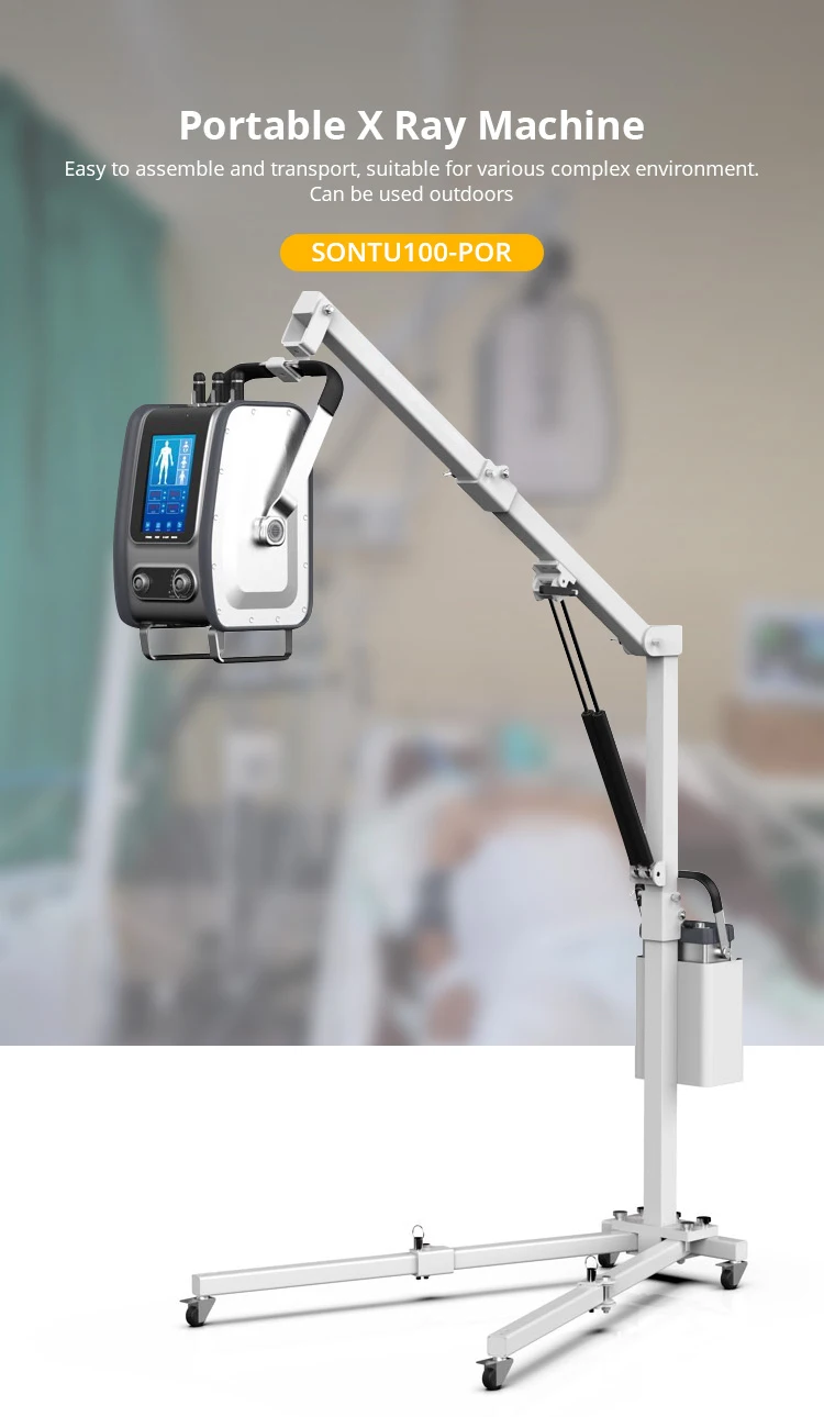 Afkp100 High Precision Xray Medical Equipment Portable Xray Machine