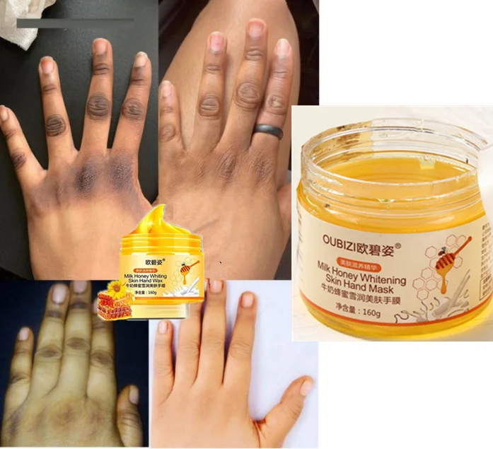 

Strong Dark knuckles remove yellow peeling oil skin extra strength body to remove skin layer