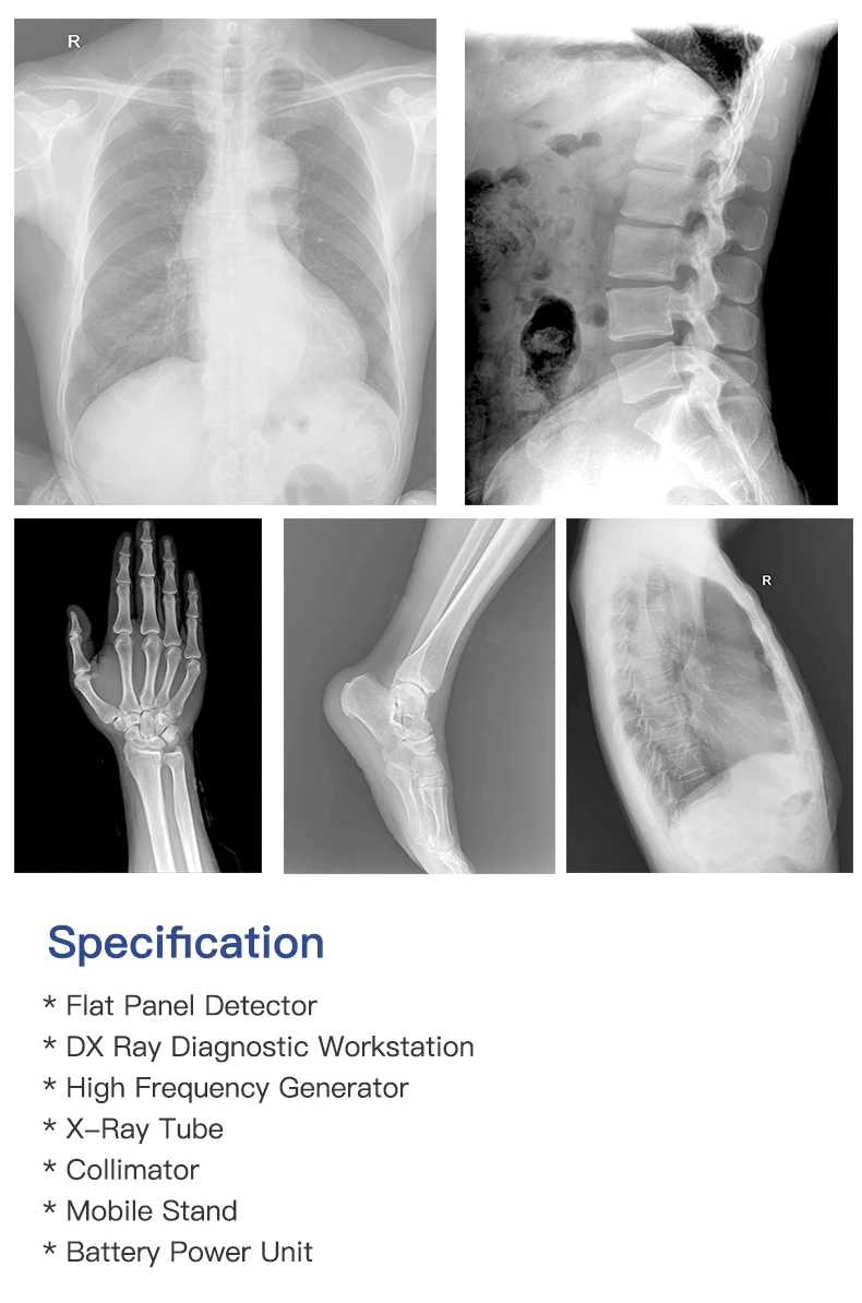 Portable digital x-ray machine prices /Mobile DR Medical x ray machine