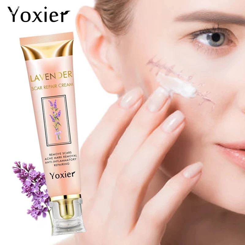 

Yoxier Remover Acne Scar Stretch Cream Marks Repair Acne Spots Acne Treatment Face Cream Blackhead Skin Care Whitening Cream 20g
