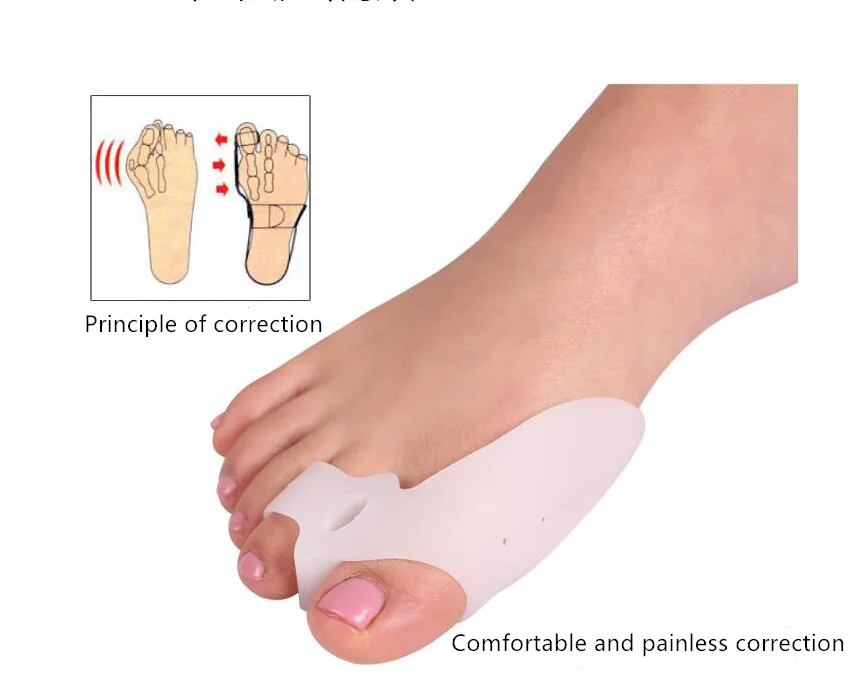 

shoe accessories corrector hallux valgus Day Night Straightener Splint bunion corrector, White, skin color
