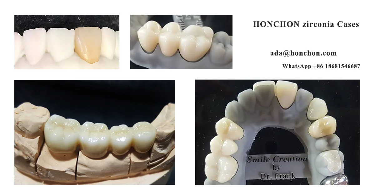 HONCHON zirconia cases.jpg