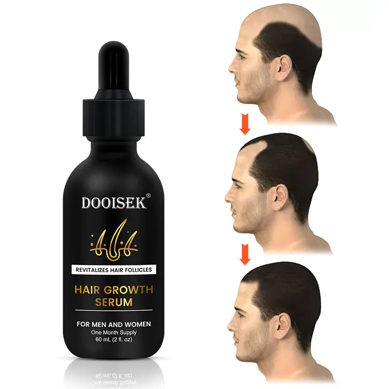 

Anti hair loss treatment serum Ginger extract oil hair regrowth care vitamin b5 biotin hair growth serum oil for men and women