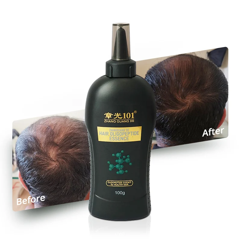 

Highly Effective Nourishing Scalp Fast Bald Hair Growth Oil Product