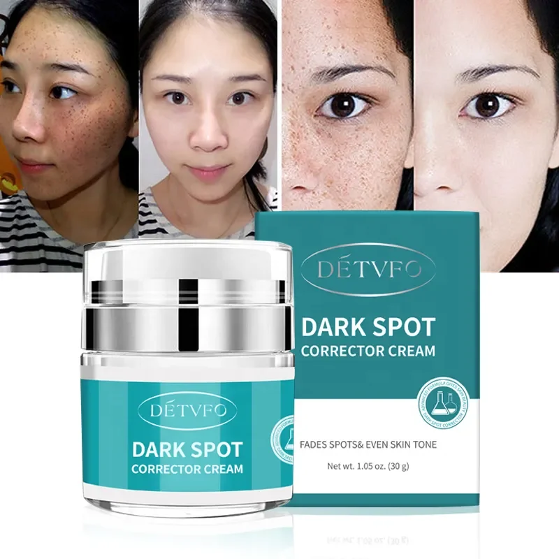

Oem Best Black Dark Spot Remover Whiting Moisturizer Skin Freckle Remove Whitening Face Cream For Face