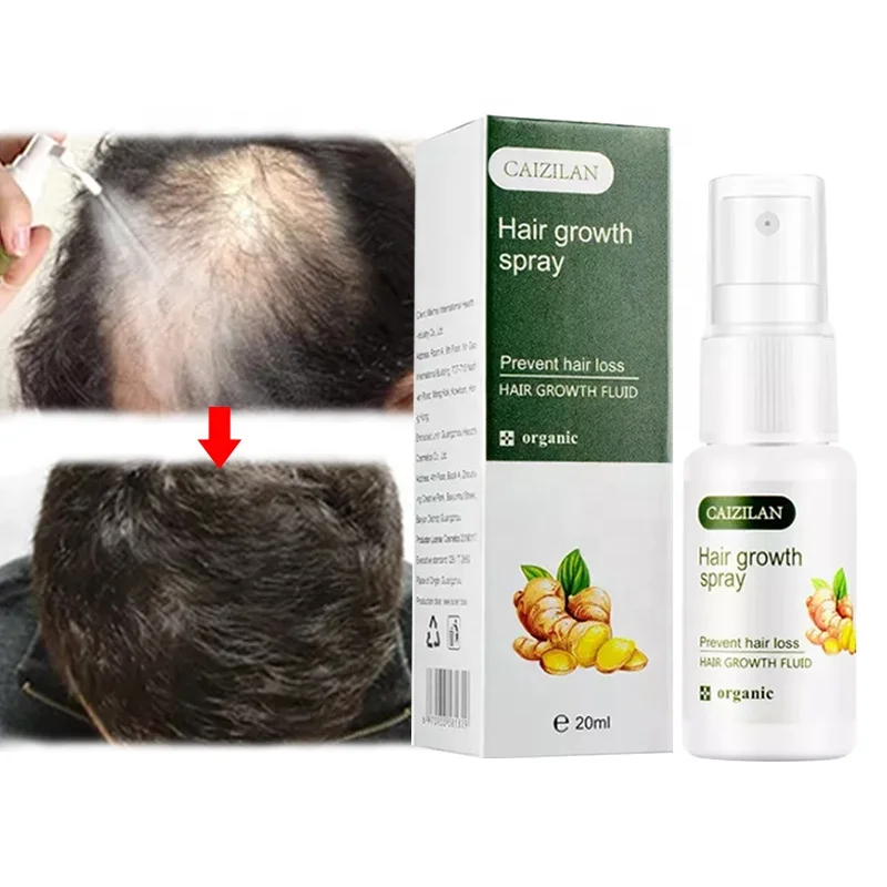 

Organic Germinal Castor Oil Hair Growth Serum 7 Days Fast Hair Growth Ginger Spray Essential Oil For Anti-Hair Loss Treatment