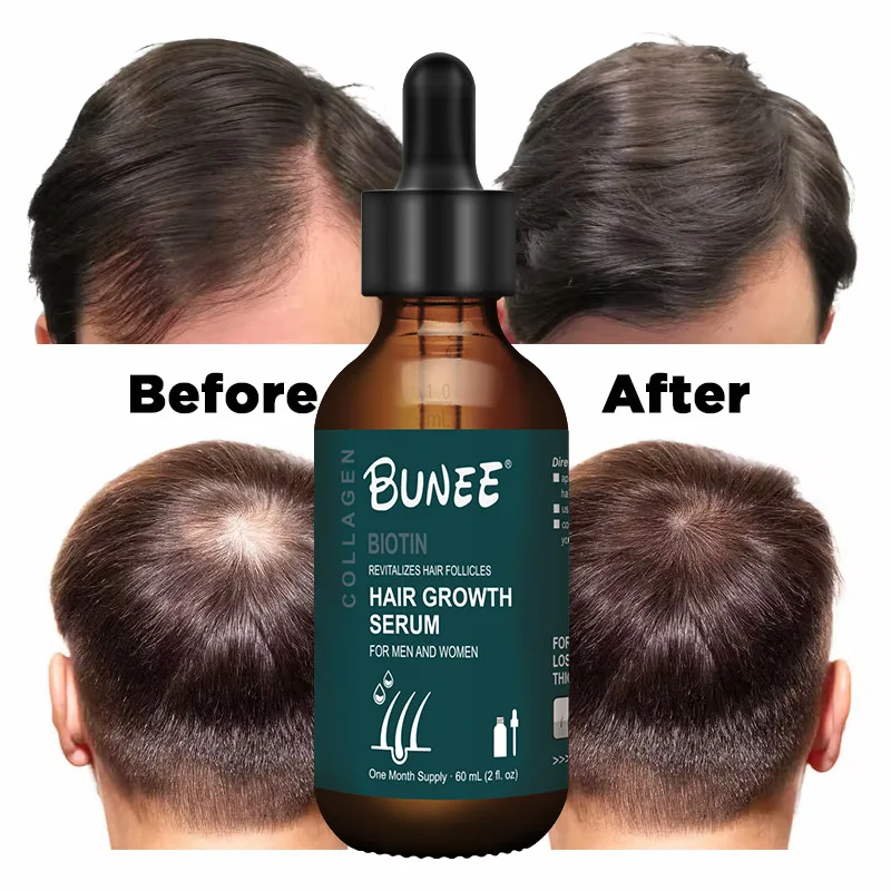 

Promotes hair growth build your own label nourishing thick care hair growth serum private label hair oil