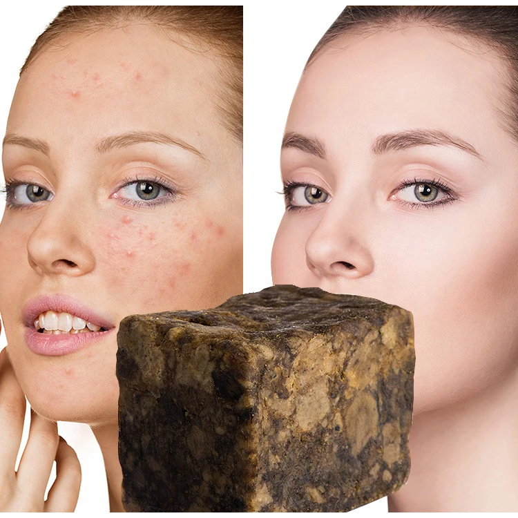

Natural Soaps Beauty Bath Body Treatment Acne Skin African Black Handmade Raw Soap
