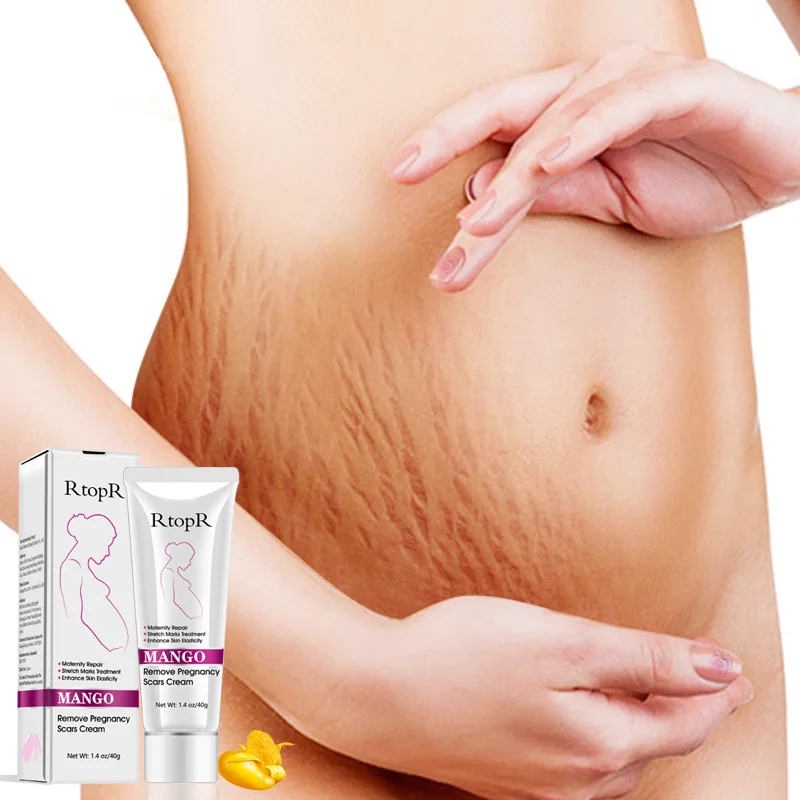 

Private Label Enhance Skin Elasticity Maternity Skin Repair Stretch Marks Removal Cream, White