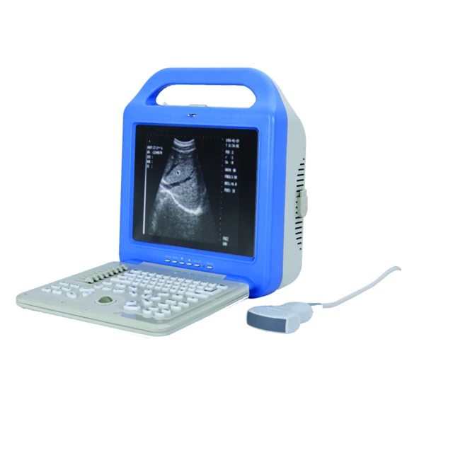 Digital Laptop Ultrasound Scanner Machine China
